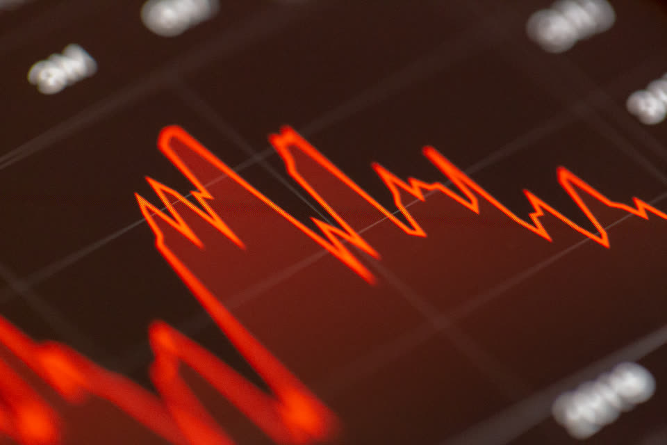Stocks Graph — LLM 토큰 지출 지수, 무엇이 내려갔나